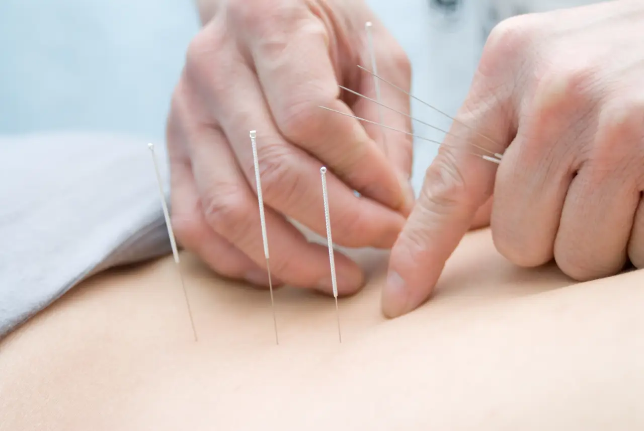 best acupuncture in scarborough